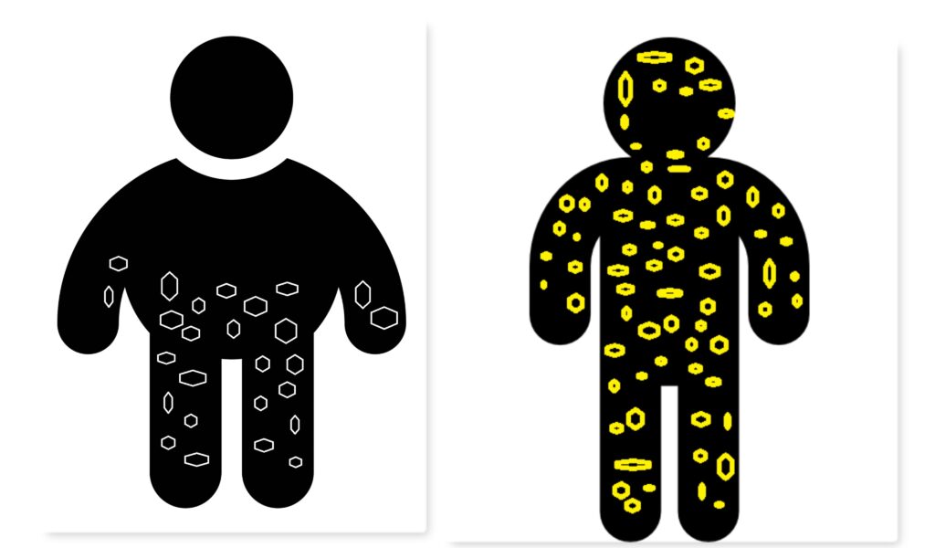 body filled with toxins